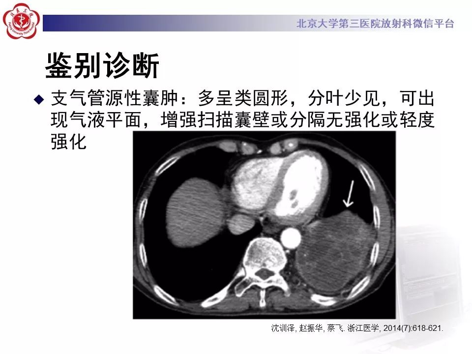 【病例】肺侵袭性粘液腺癌1例CT