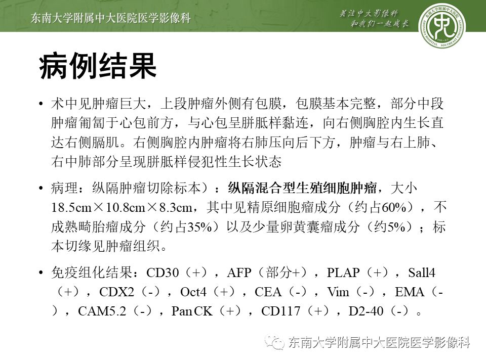 【病例】纵隔生殖细胞肿瘤1例CT