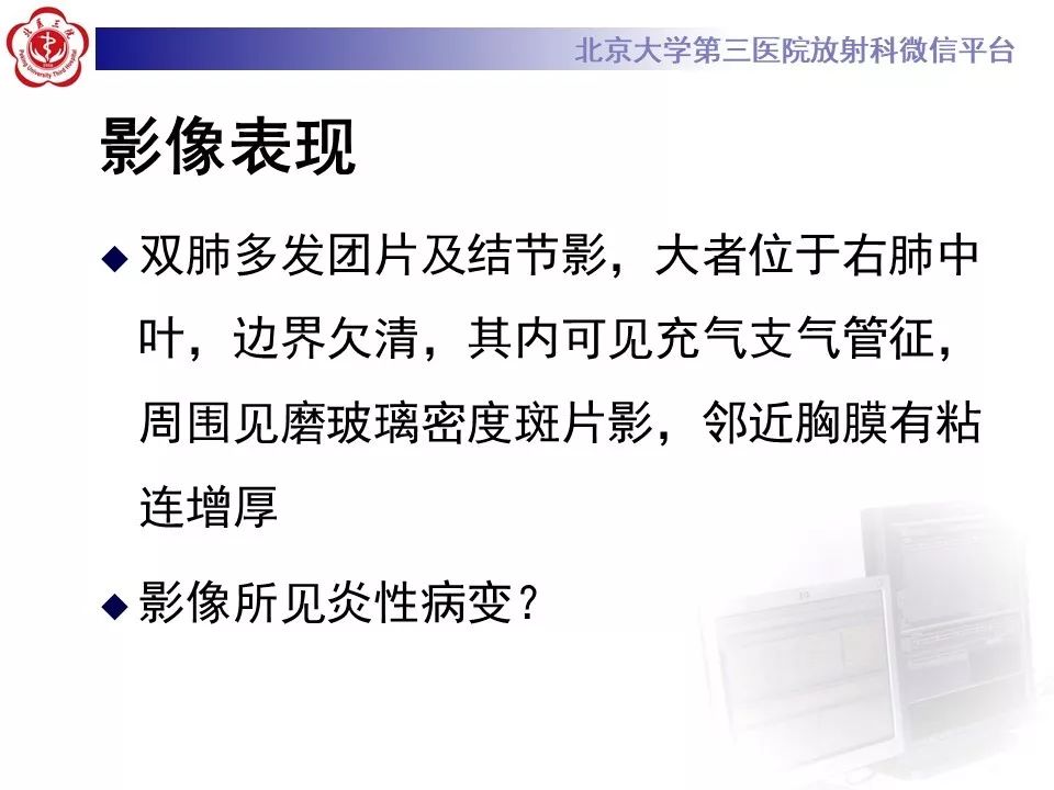 【病例】肺隐球菌病1例CT影像