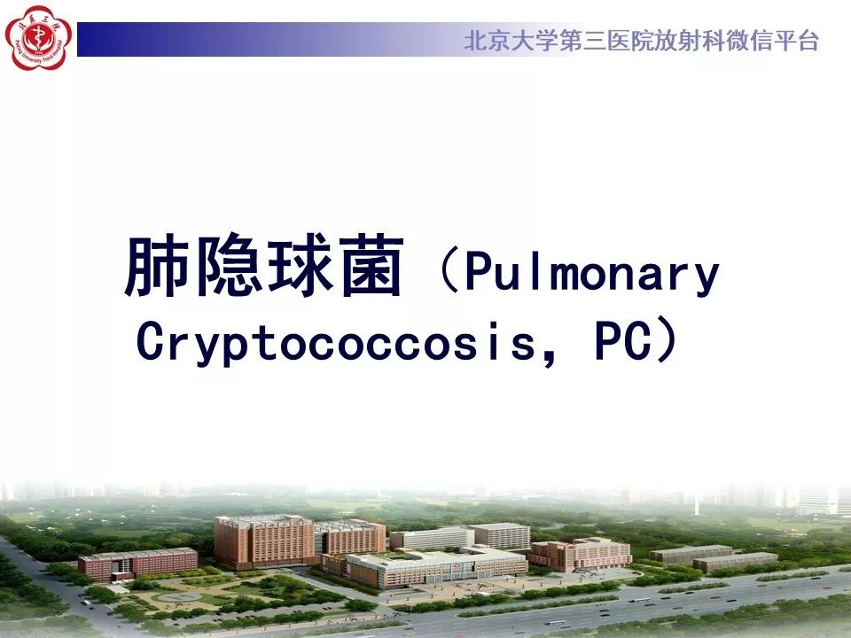 【病例】肺隐球菌病1例CT影像