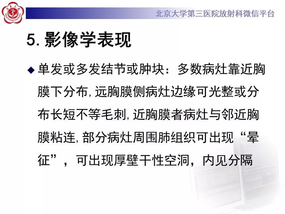 【病例】肺隐球菌病1例CT影像