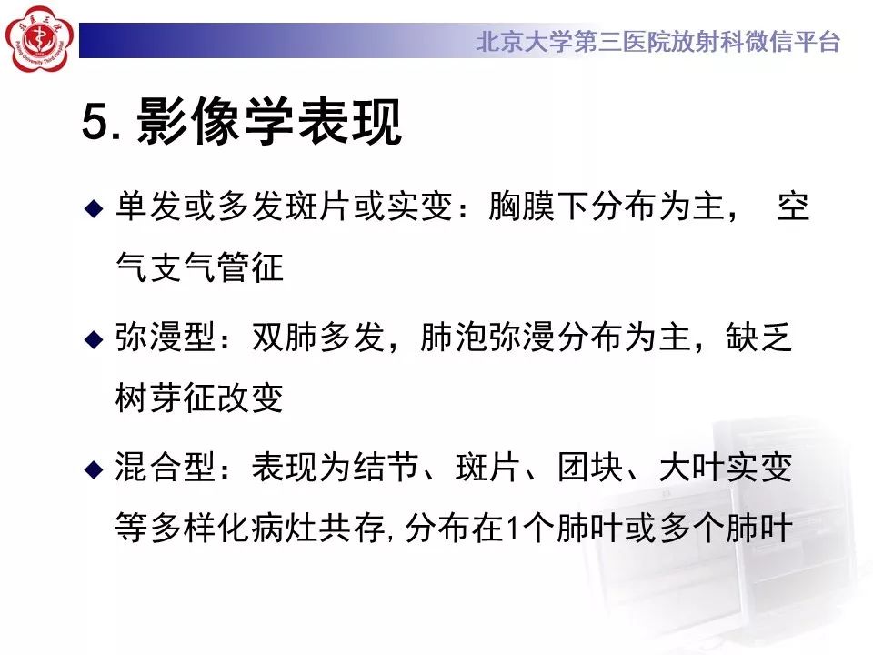 【病例】肺隐球菌病1例CT影像