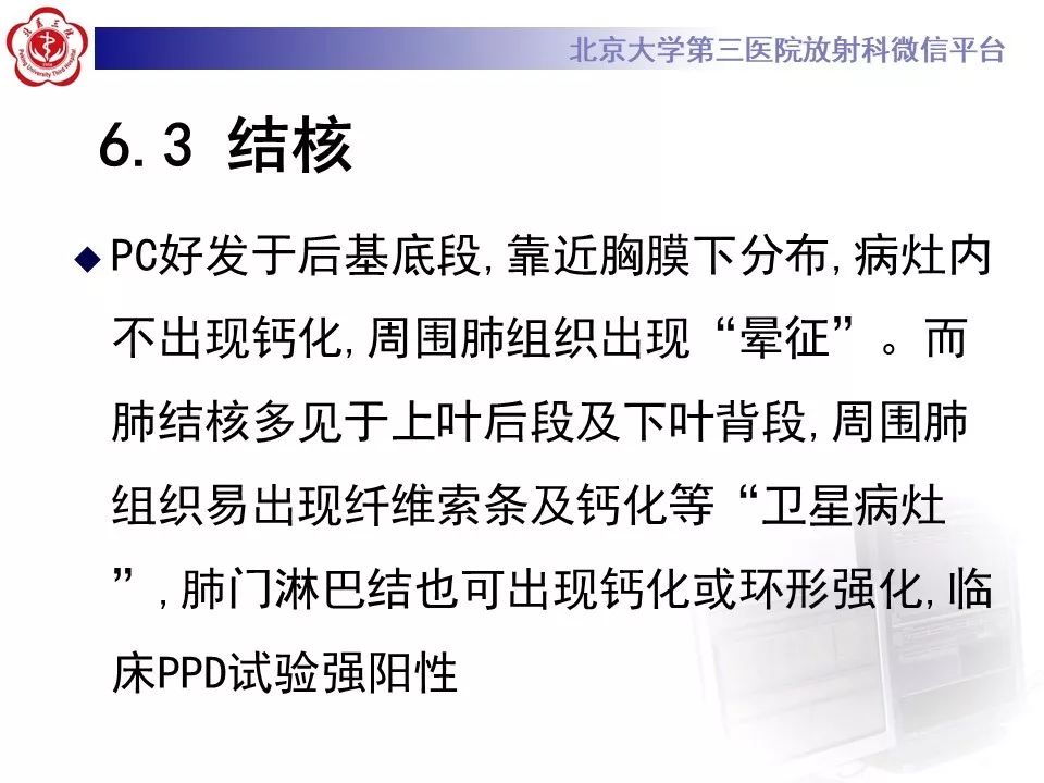 【病例】肺隐球菌病1例CT影像