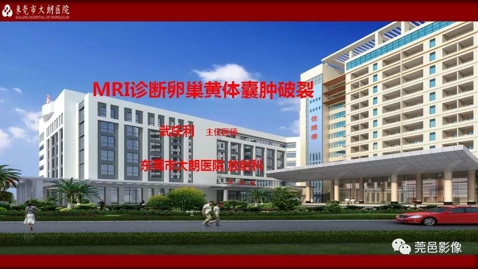 【PPT】MRI诊断卵巢黄体囊肿破裂