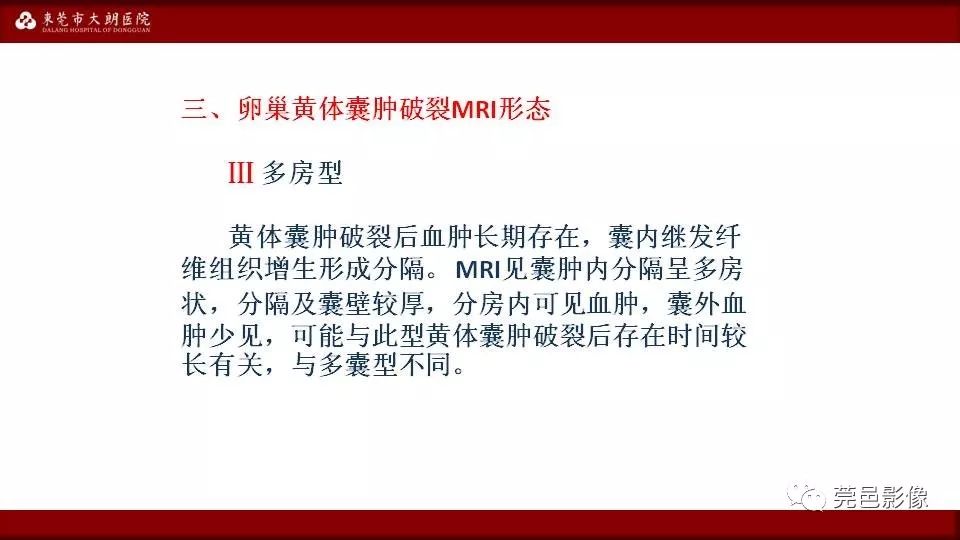 【PPT】MRI诊断卵巢黄体囊肿破裂
