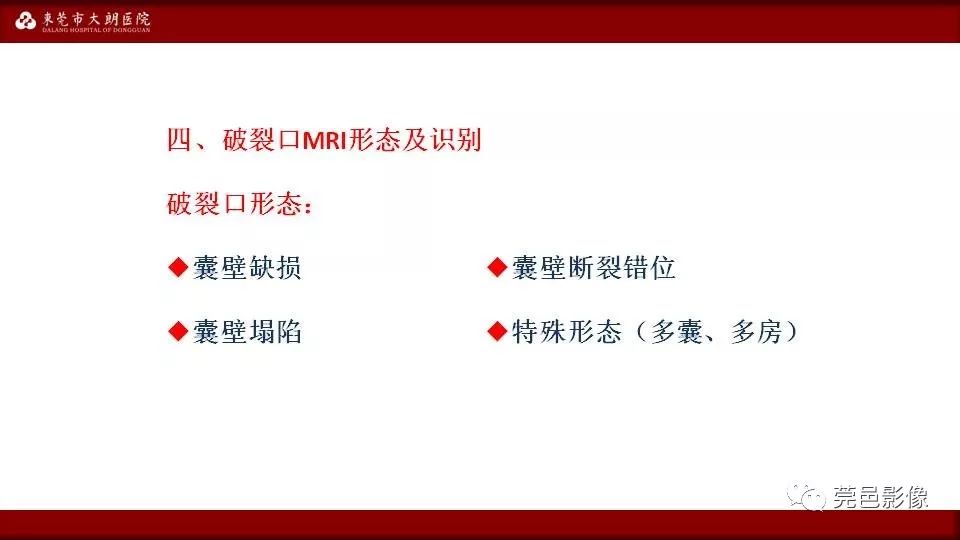 【PPT】MRI诊断卵巢黄体囊肿破裂