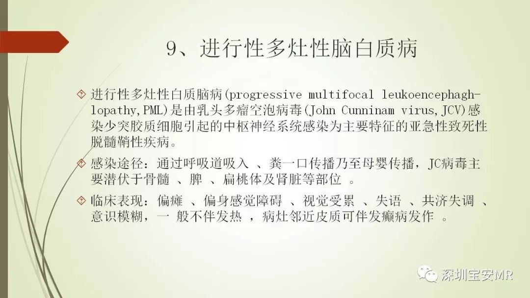 【PPT】病毒性脑炎的影像表现
