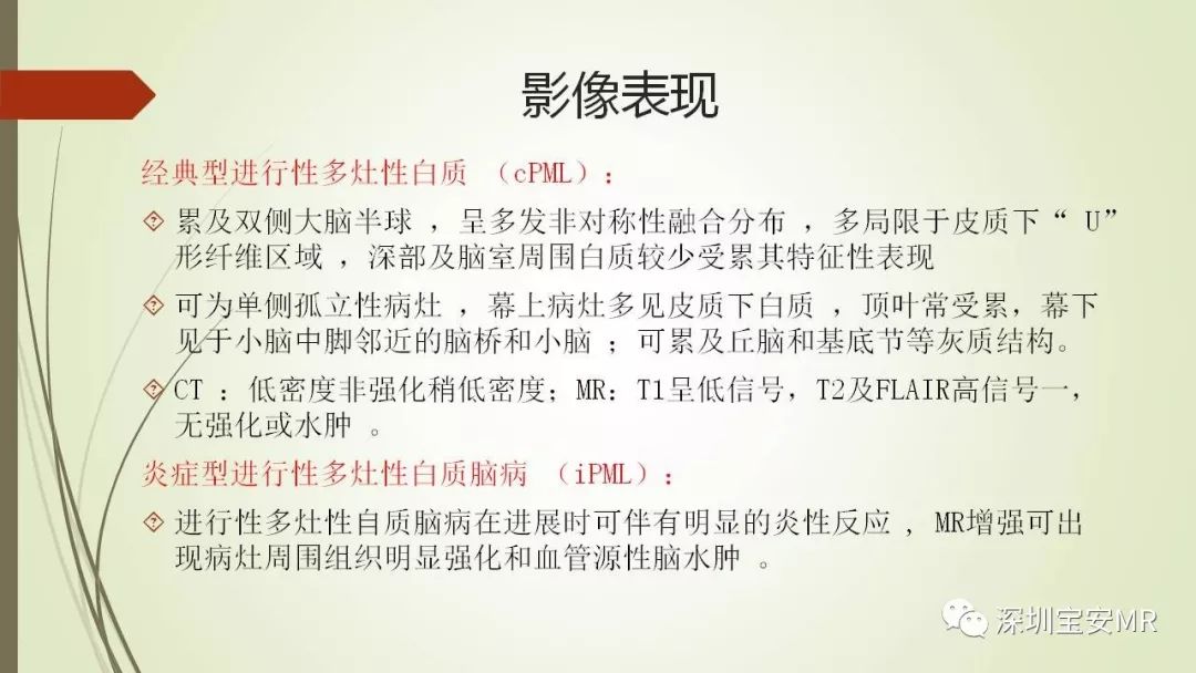 【PPT】病毒性脑炎的影像表现