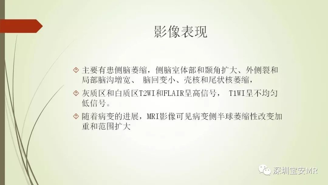 【PPT】病毒性脑炎的影像表现