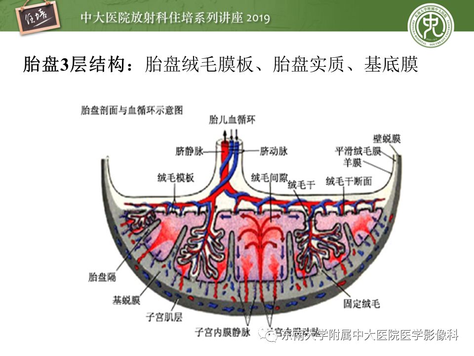 【PPT】胎盘相关MR诊断