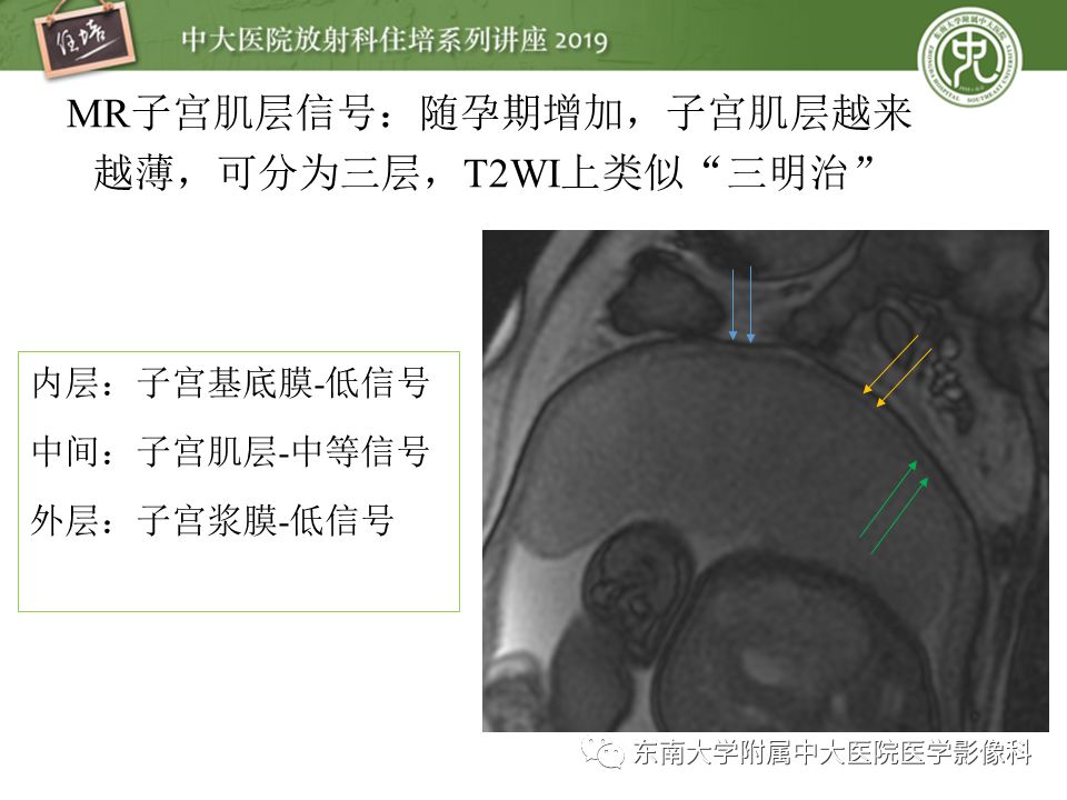 【PPT】胎盘相关MR诊断