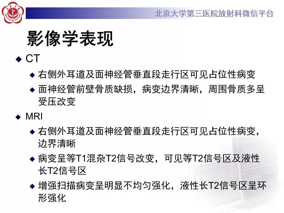 【病例】面神经鞘瘤1例CT及MR影像