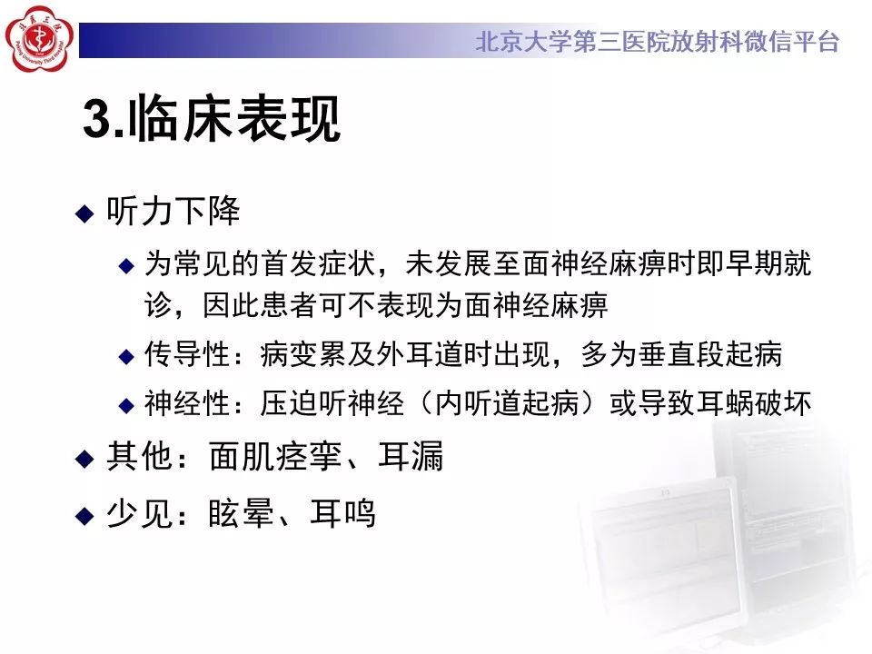 【病例】面神经鞘瘤1例CT及MR影像