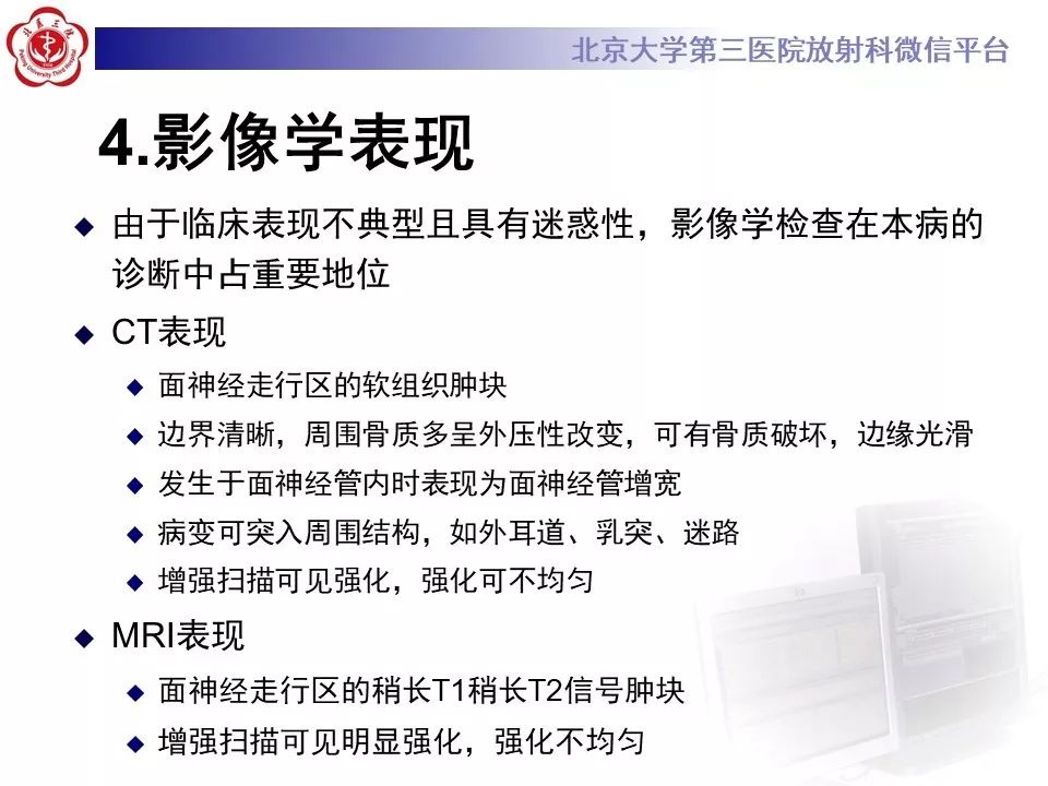 【病例】面神经鞘瘤1例CT及MR影像