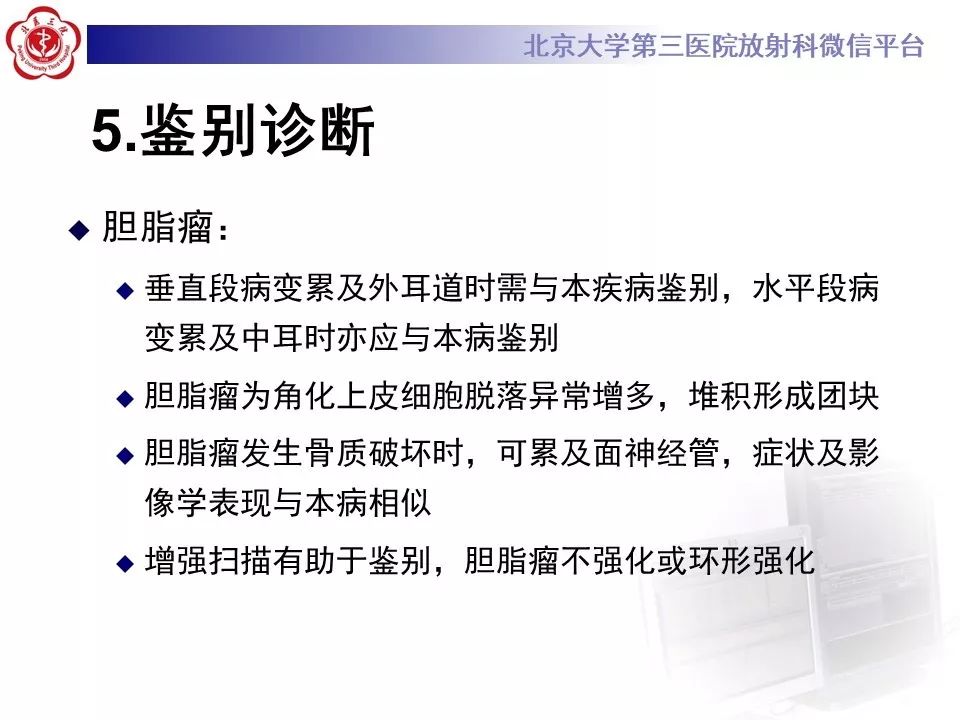 【病例】面神经鞘瘤1例CT及MR影像