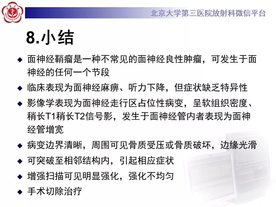 【病例】面神经鞘瘤1例CT及MR影像