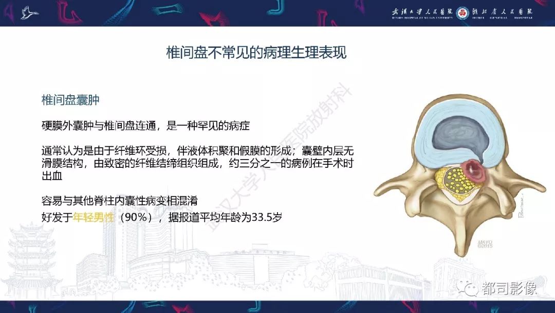 【PPT】椎间盘不常见病变影像诊断