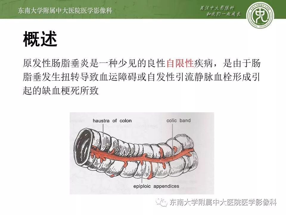 【病例】肠脂垂炎1例CT影像
