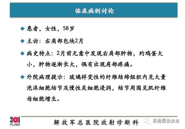 【PPT】软组织肿瘤磁共振诊断分析思路