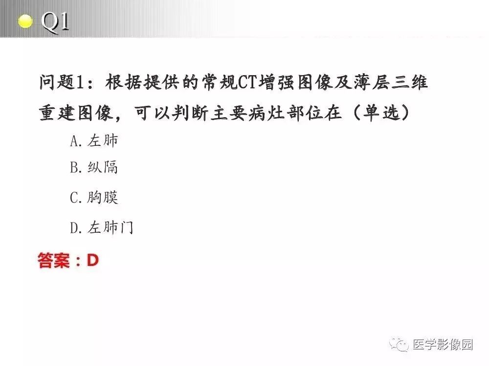 【病例】左肺门巨大淋巴结增生症1例CT