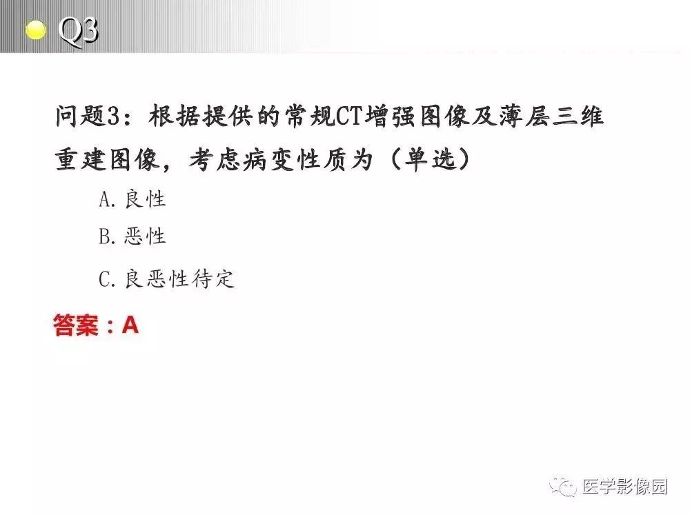 【病例】左肺门巨大淋巴结增生症1例CT