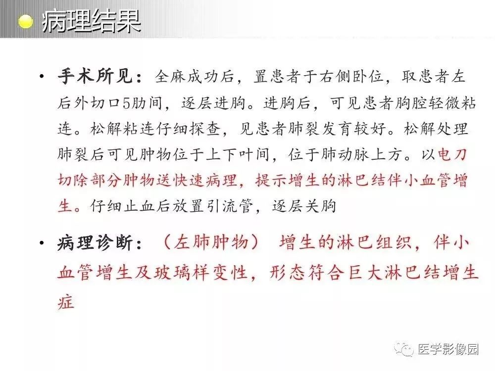 【病例】左肺门巨大淋巴结增生症1例CT
