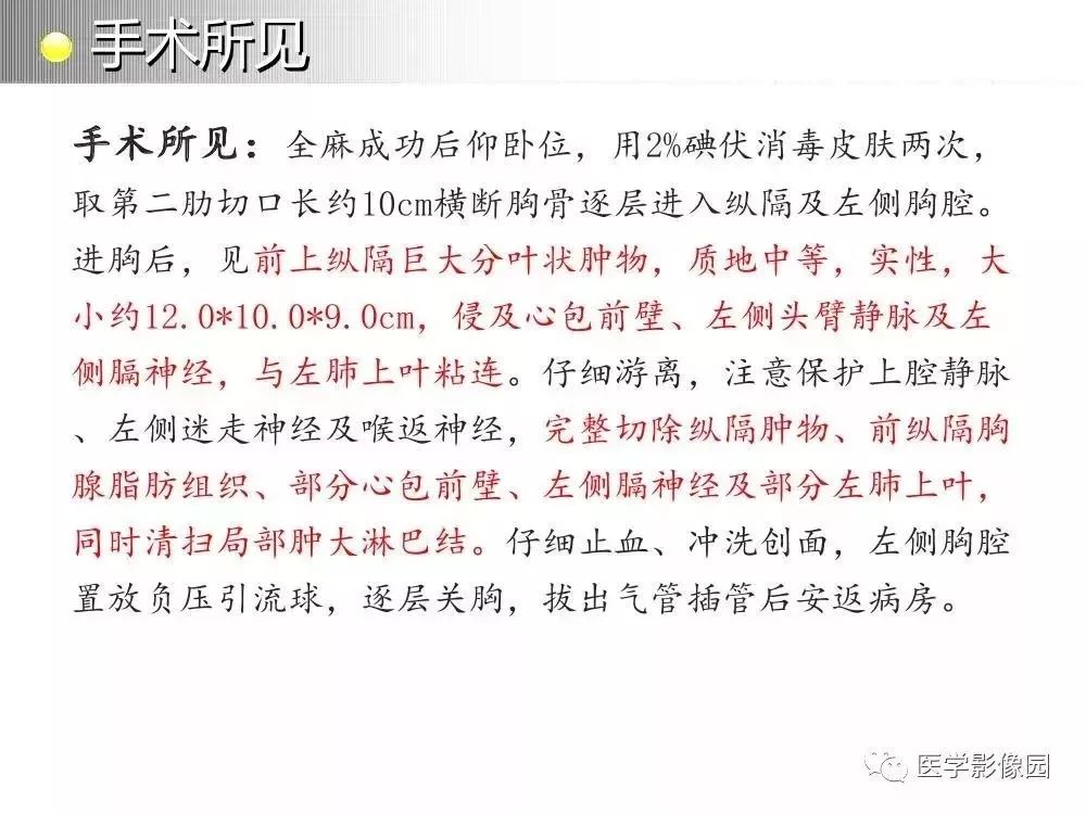 【病例】左肺门巨大淋巴结增生症1例CT