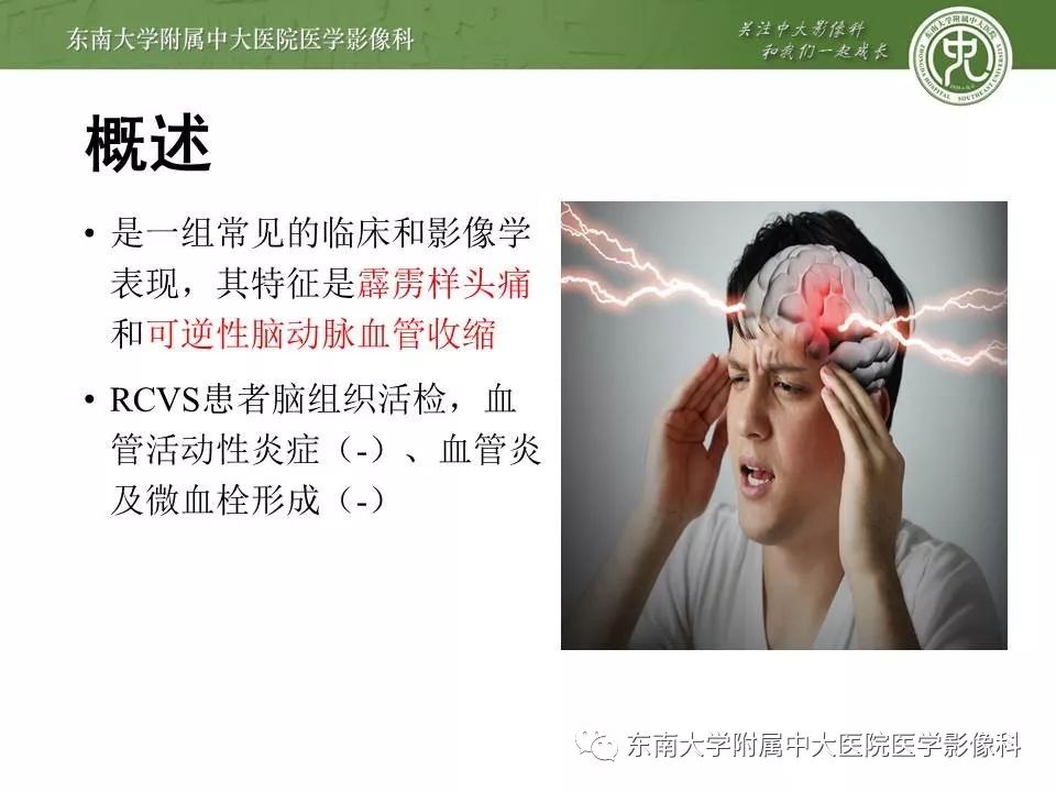 【病例】可逆性脑血管收缩综合征1例MR