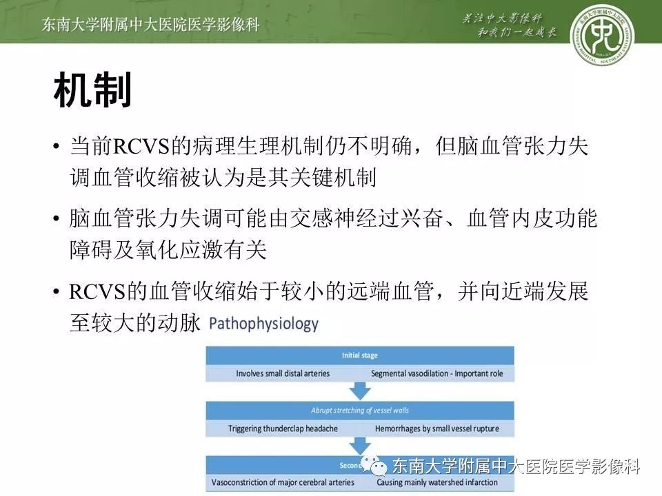 【病例】可逆性脑血管收缩综合征1例MR