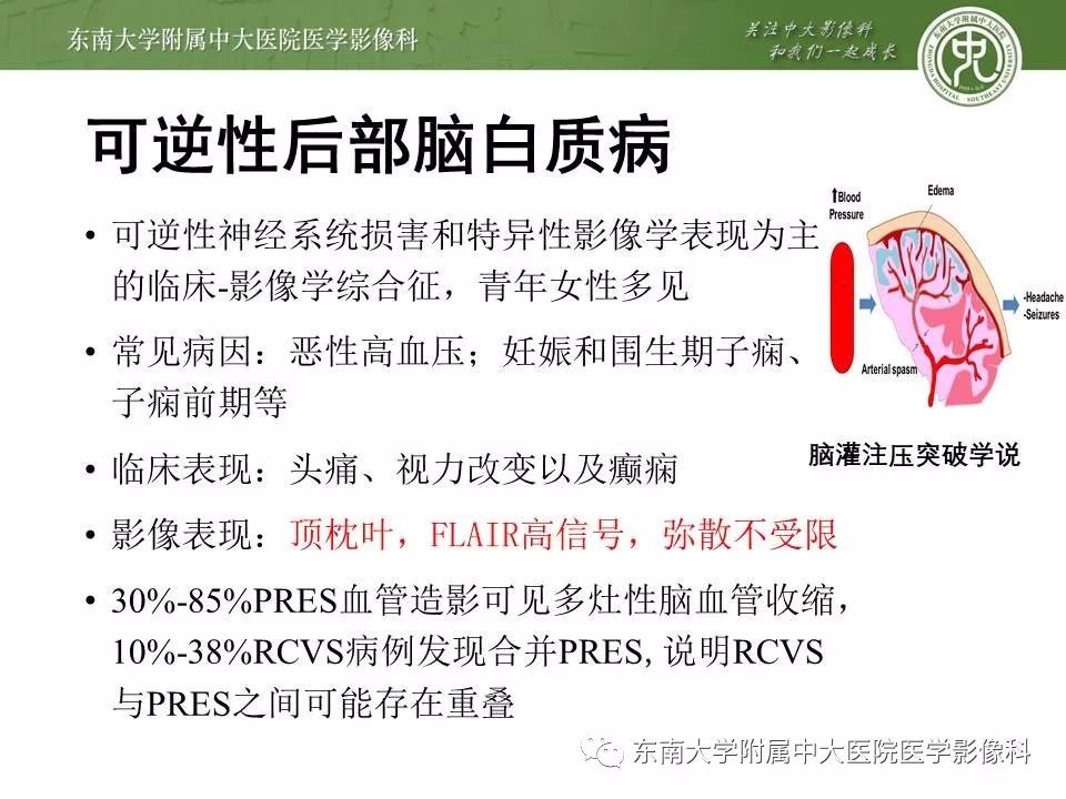 【病例】可逆性脑血管收缩综合征1例MR