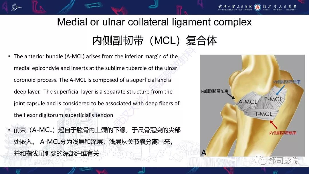 【PPT】肝脏血管肉瘤影像诊断
