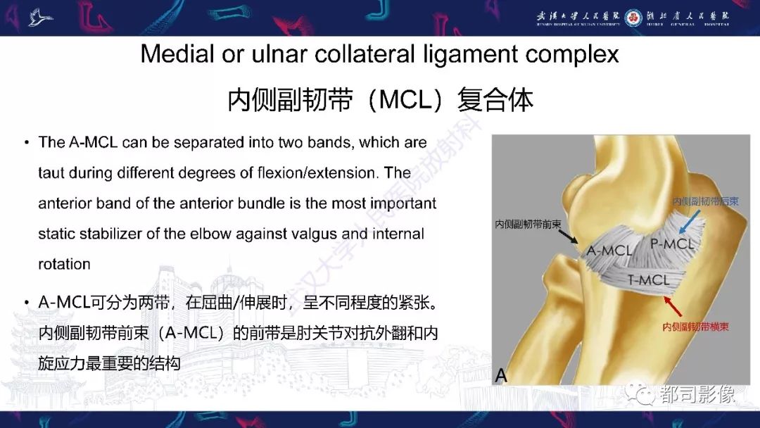 【PPT】肝脏血管肉瘤影像诊断