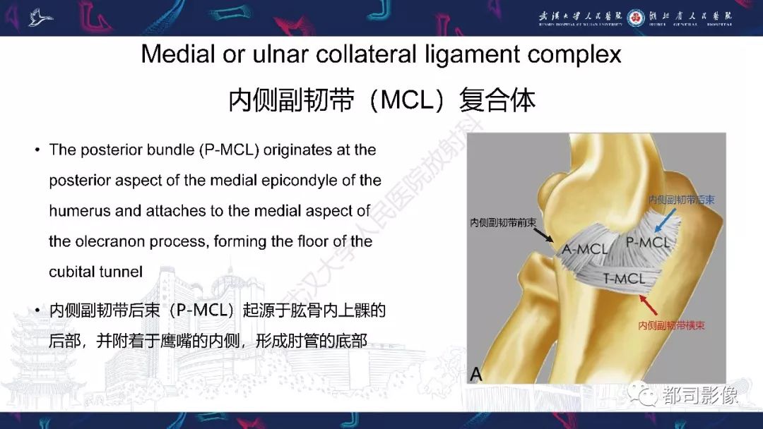 【PPT】肝脏血管肉瘤影像诊断