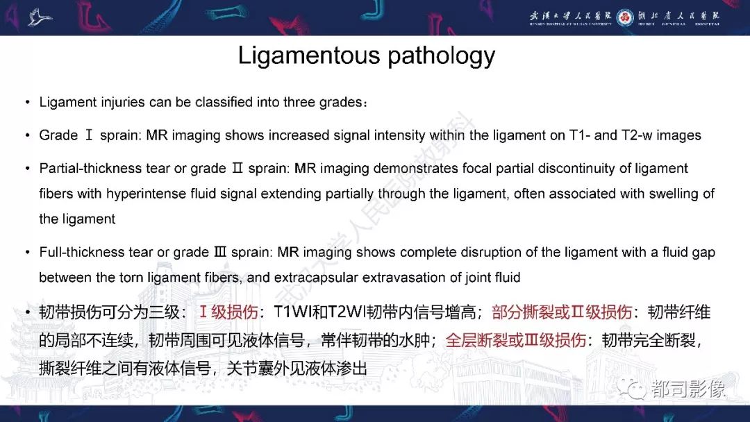 【PPT】肝脏血管肉瘤影像诊断