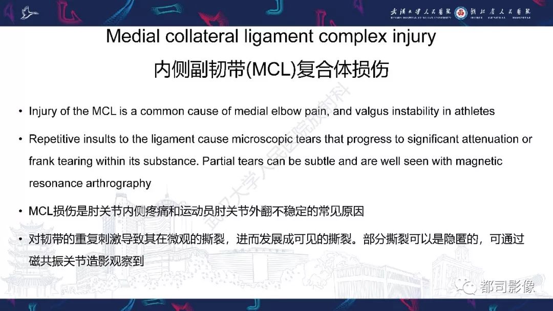 【PPT】肝脏血管肉瘤影像诊断