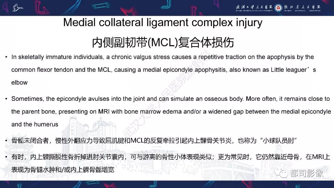 【PPT】肝脏血管肉瘤影像诊断