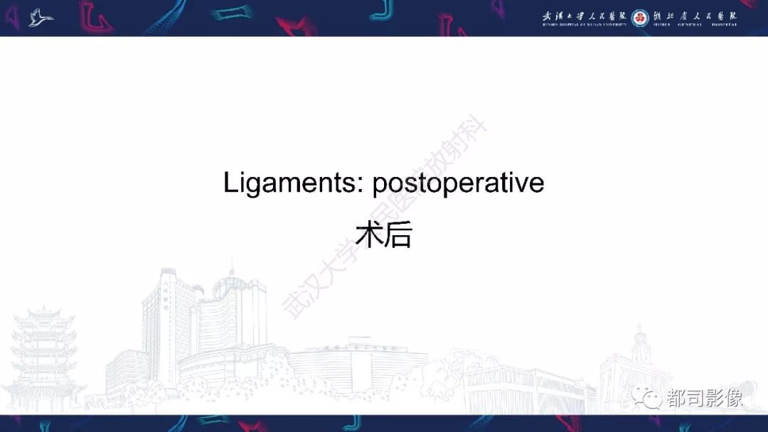 【PPT】肝脏血管肉瘤影像诊断