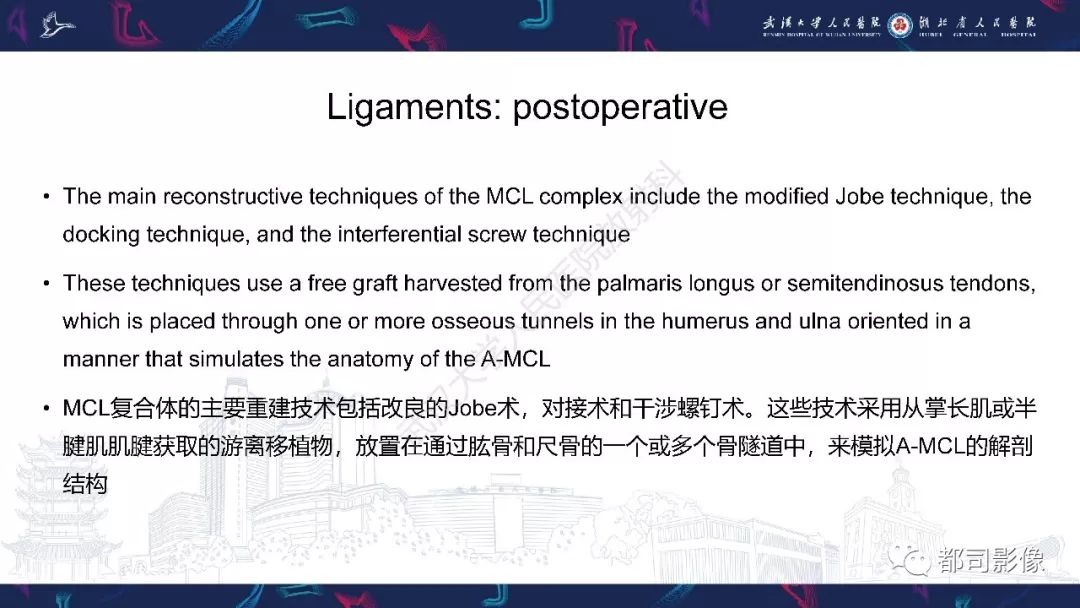 【PPT】肝脏血管肉瘤影像诊断