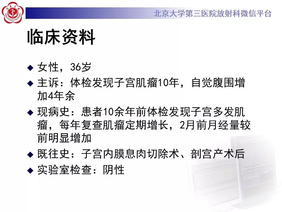 【病例】静脉内平滑肌瘤病1例CT及MR影像