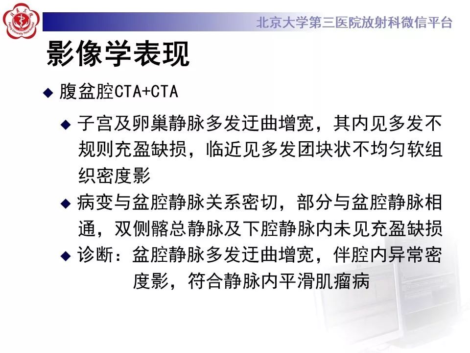 【病例】静脉内平滑肌瘤病1例CT及MR影像