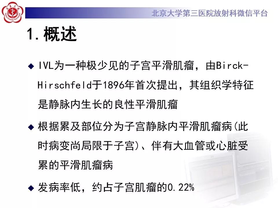 【病例】静脉内平滑肌瘤病1例CT及MR影像