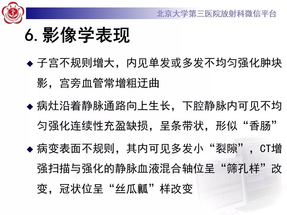 【病例】静脉内平滑肌瘤病1例CT及MR影像