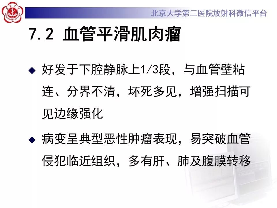 【病例】静脉内平滑肌瘤病1例CT及MR影像