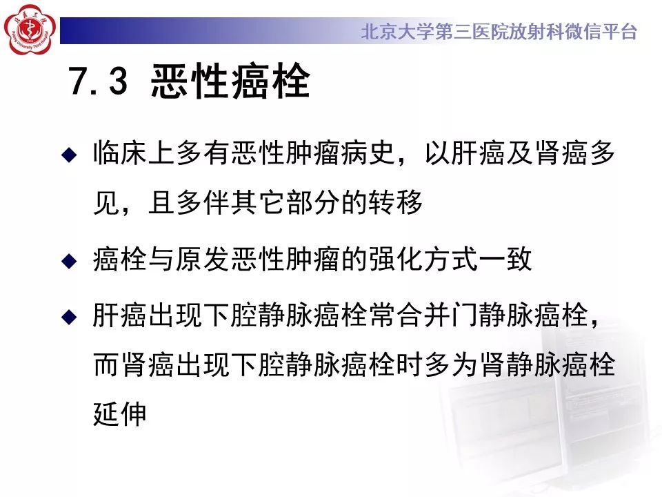 【病例】静脉内平滑肌瘤病1例CT及MR影像