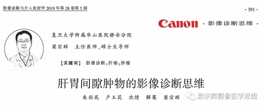 【病例】外生性肝癌1例CT影像诊断思维
