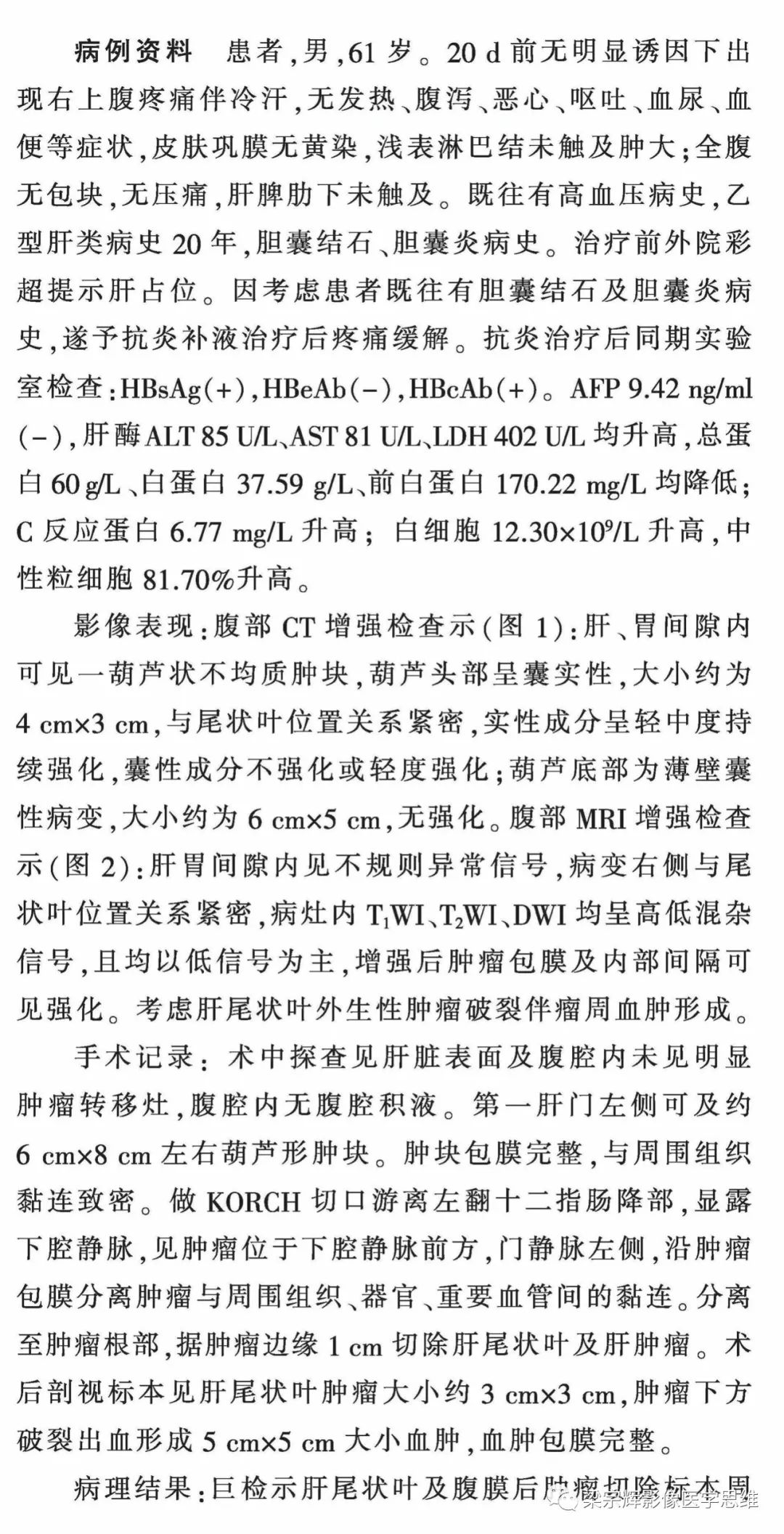 【病例】外生性肝癌1例CT影像诊断思维