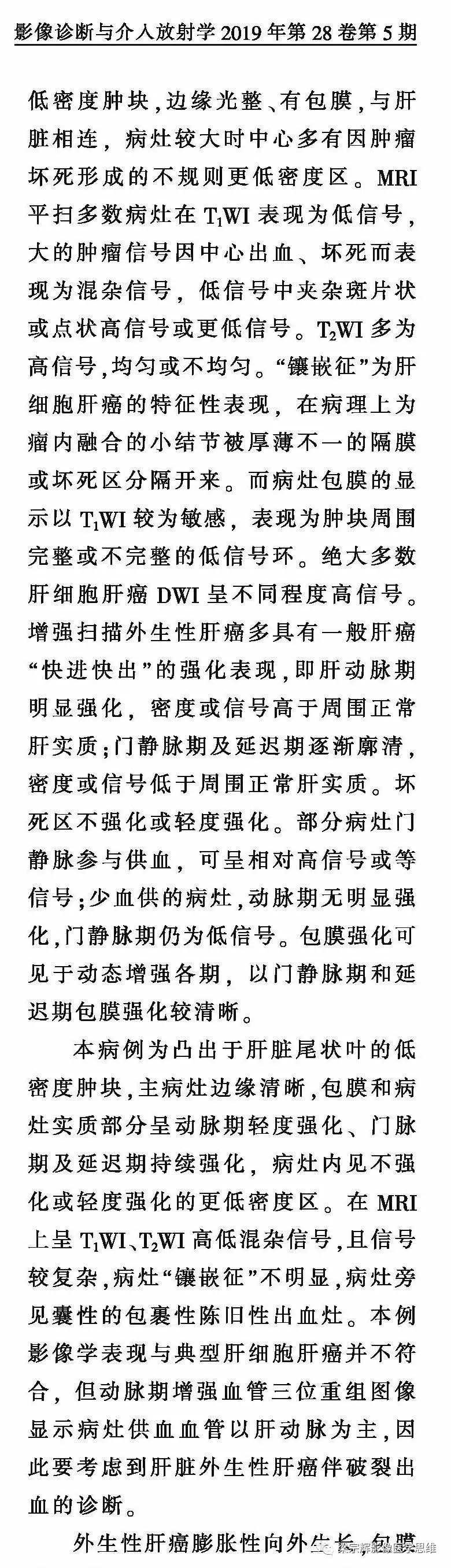 【病例】外生性肝癌1例CT影像诊断思维