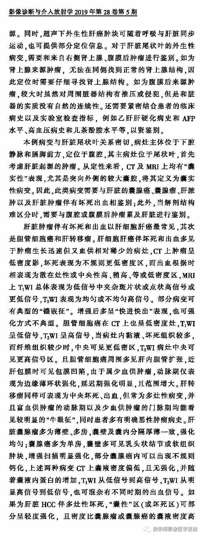 【病例】外生性肝癌1例CT影像诊断思维