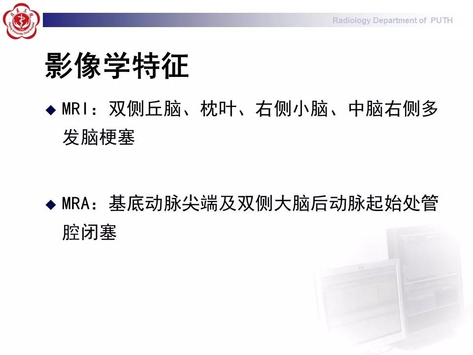 【病例】基底动脉尖综合征1例MR