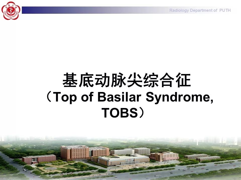 【病例】基底动脉尖综合征1例MR